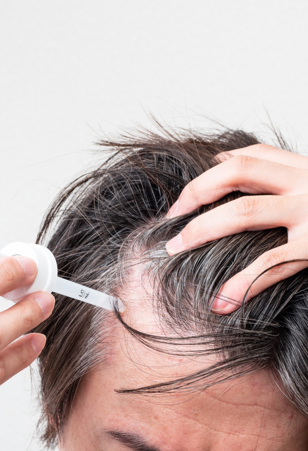besoins cheveux repousse minoxidil definition